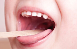 大府市（愛知県）の歯医者、斎藤歯科医院で舌小帯短縮症についての解説