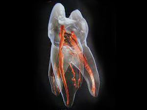 大府市（愛知県）の歯医者、斎藤歯科医院で歯の根っこの治療が長引く理由と治療期間を短縮するポイントを解説