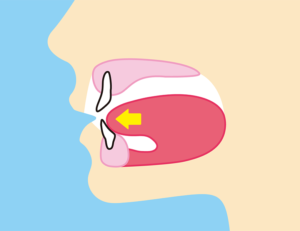 大府市（愛知県）の歯医者、斎藤歯科医院でなぜ無意識に舌で前歯を押すクセがつく？原因と対処法を解説